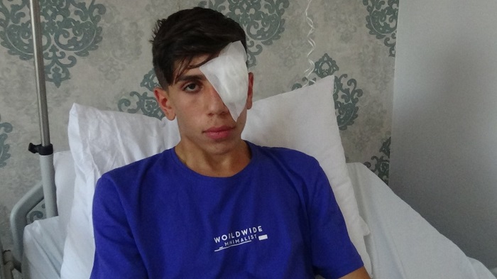 Satışı yasak olan maytap, 17 yaşındaki genci sol gözünden etti
