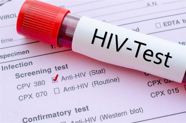 HIV fobisi ile başa çıkma yolları