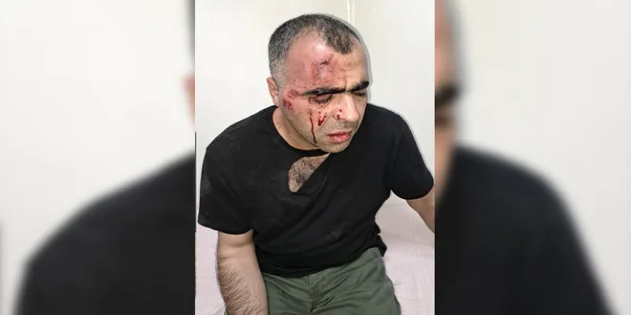 Gazeteci Sinan Aygül'e saldırı