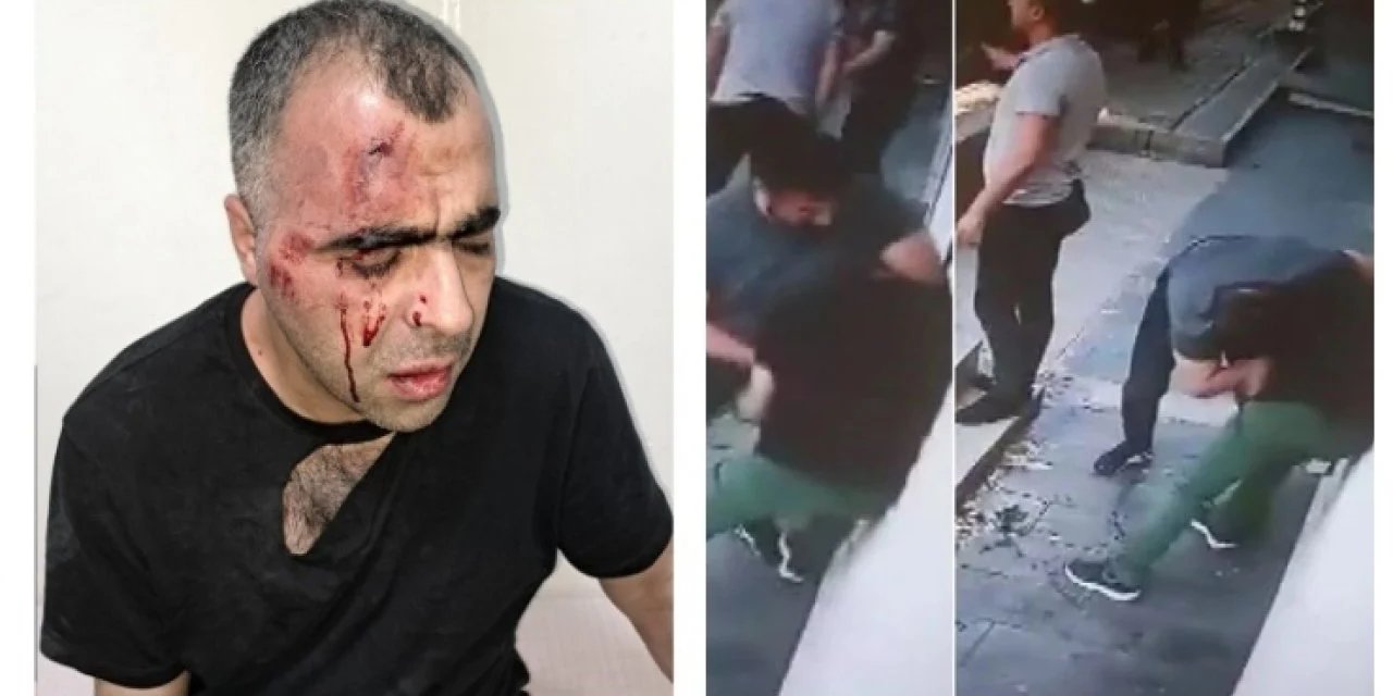 Gazeteci Sinan Aygül’e saldıran biri polis iki koruma tahliye edildi