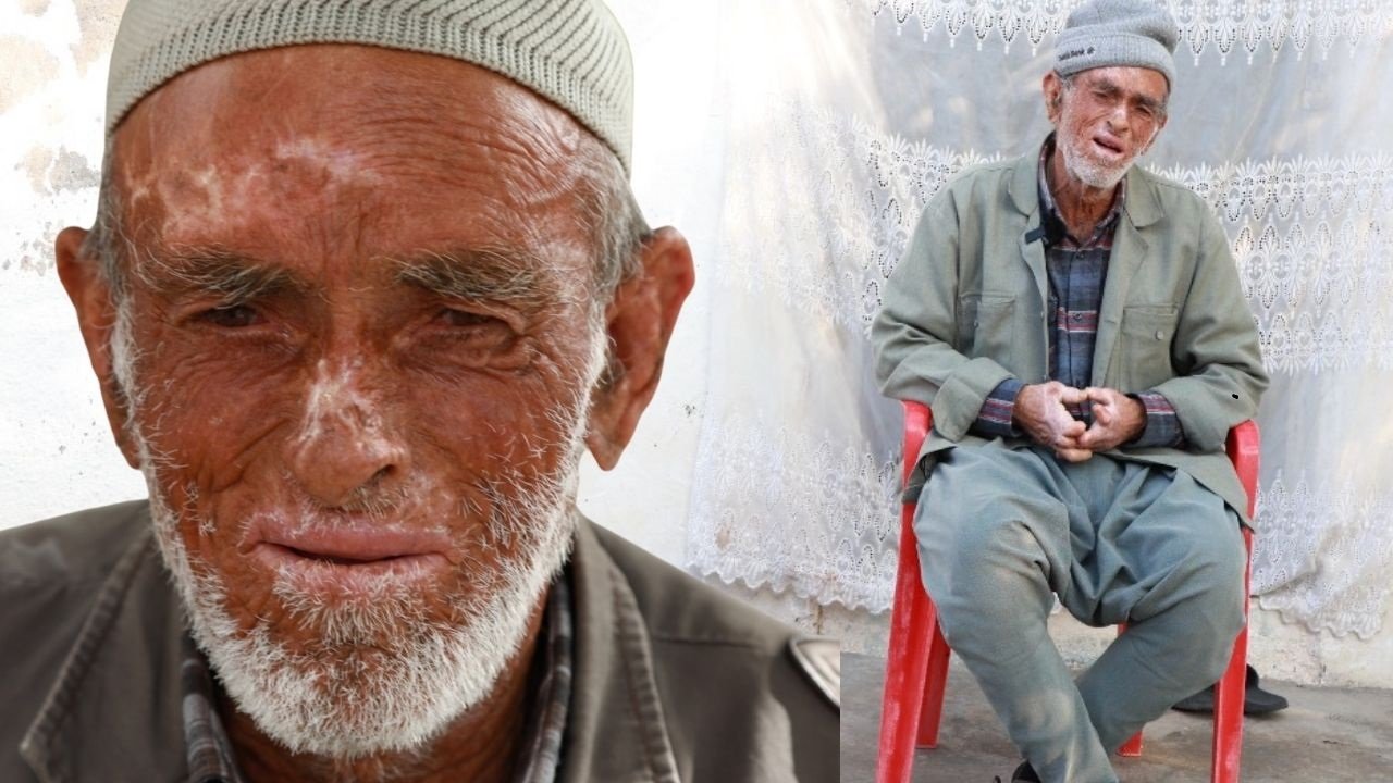 Diyarbakır'da 66 yıl önceki hastalığın korkunç izleri: Birîna Reş