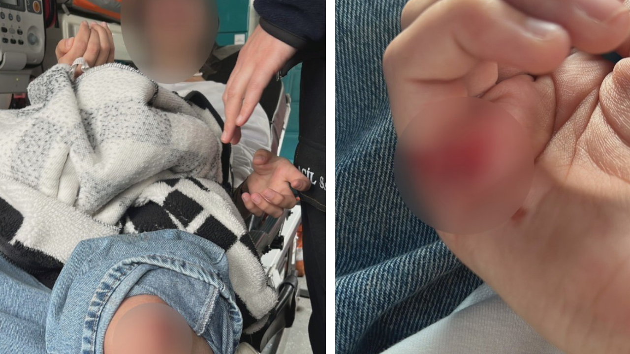 15 yaşındaki Ece’ye sokak köpekleri saldırdı