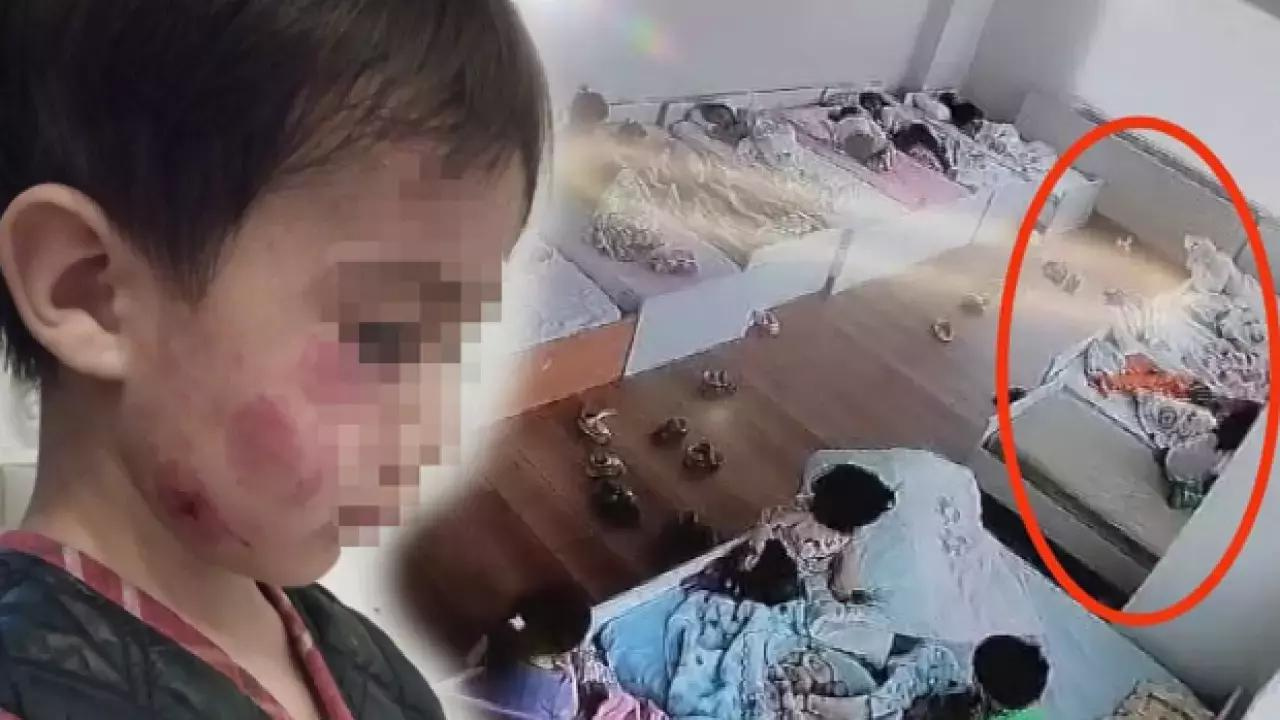 4 yaşındaki çocuk, uyuyan arkadaşını 13 yerinden ısırdı!