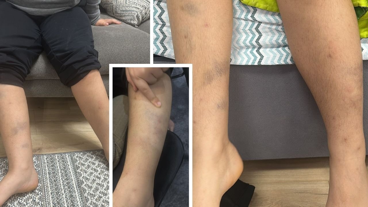 Yer Diyarbakır; Özel okulda 8 yaşındaki çocuğa öğretmen şiddeti