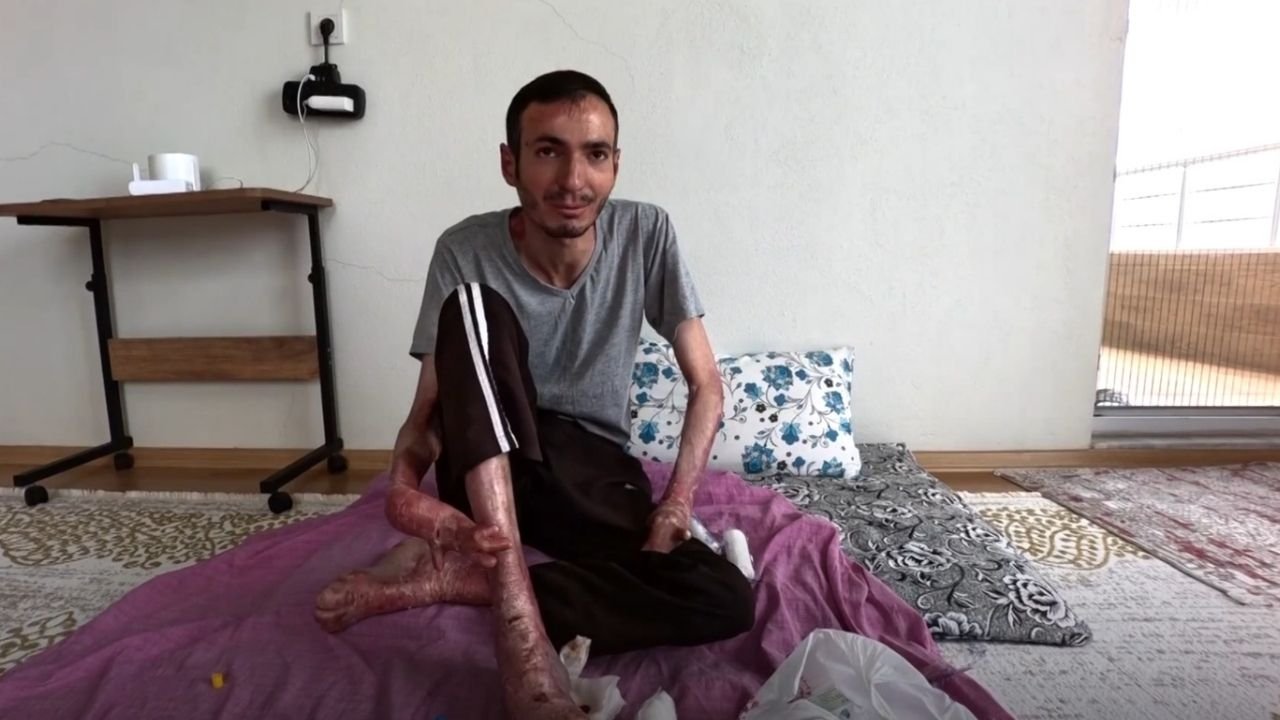 Diyarbakır’da bir azim hikayesi: Yaralarına çare için okula gitmeden İngilizce öğrendi