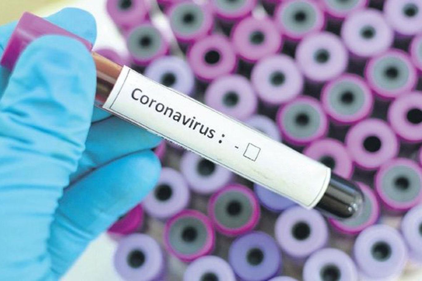 Silvan'da 4 kişinin korona virüs testi pozitif çıktı