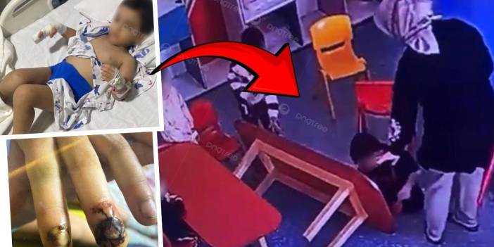 Diyarbakır'da özel okulda skandal: Çocuğun parmakları ezildi, çocuk ve aile dışlandı!